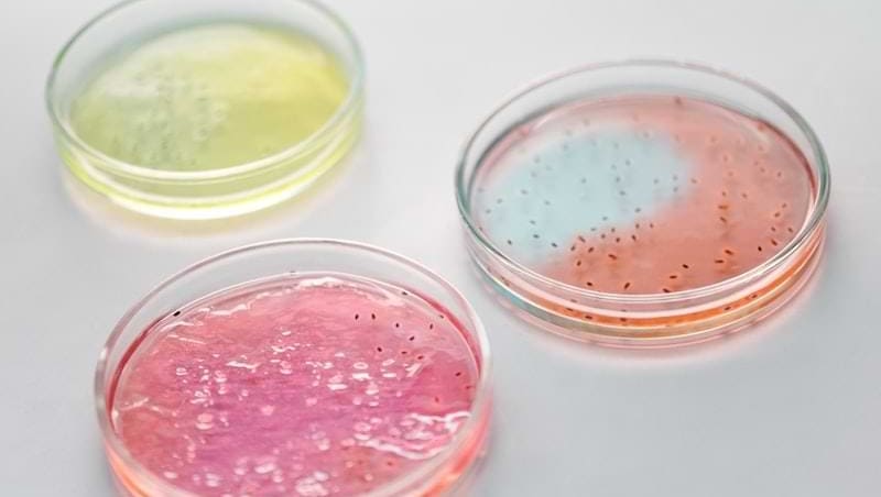 fermenti lattici cistite | Dimann