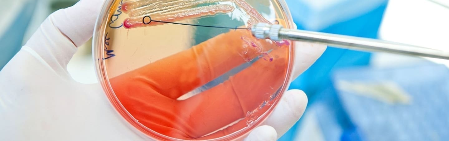 Escherichia coli: tutto ciò che devi sapere | Dimann
